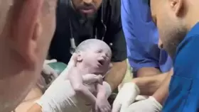 قصة روح.. ولادة مأساوية في غزة