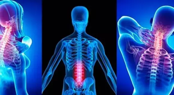 تقويم العمود الفقري"Chiropractic"مسموح في السعودية بشروط