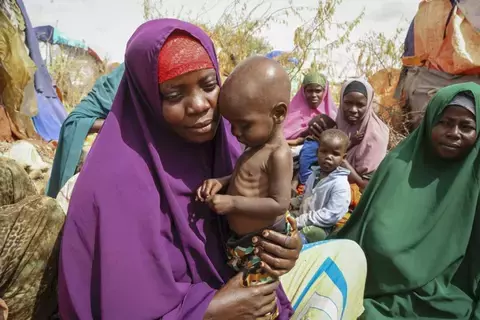 الجوع ينهش أطفال الصومال